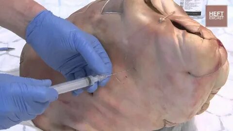 Chest Tube Insertion Steps / Cardiac surgery Basicmedical Ke