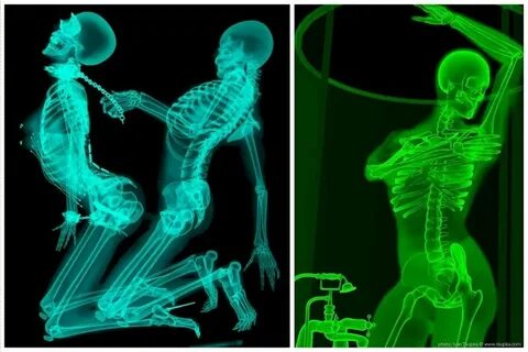 Мир в рентгеновских лучах - вид искусства, где видна изнанка