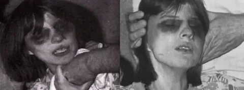 Anneliese Michel: The True Story Behind 'The Exorcism Of Emi