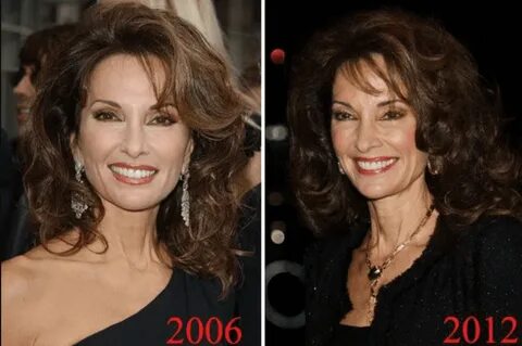 Susan Lucci Plastic Surgery Before And After Pictures