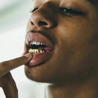 ριитєяєѕт : F R E ♡ grillz ✨ in 2019 Gold teeth, Grillz, Gol