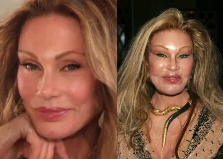 26 Most Expensive Celebrity Plastic Surgeries Ever and How M
