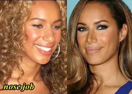 Leona Lewis Nose Job Before and After - Plastic Surgery Hits