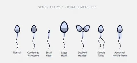 Male Semen Analysis - What Is Measured? - ExSeed