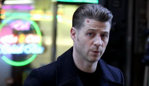 Ben McKenzie Sports Bloody Face During 'Gotham' Filming Benj