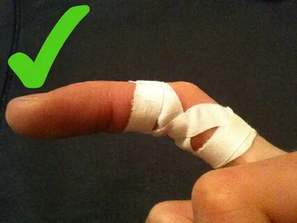Injured: Injured Finger
