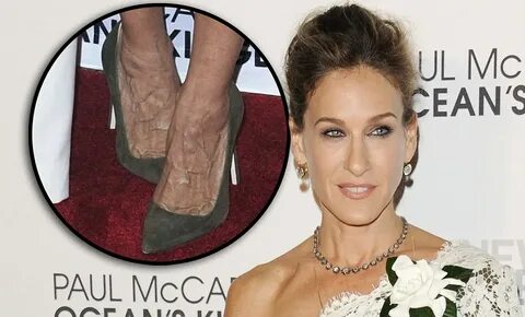 Sarah Jessica Parker sports unsightly bulging veins on her f