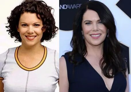 Lauren Graham Plastic Surgery - Before And After Nose Job