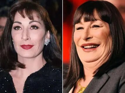 Anjelica Huston - Plastic surgery from Fairy Tale