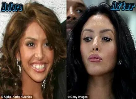 Vanessa Bryant Plastic Surgery Before and After Pictures Van