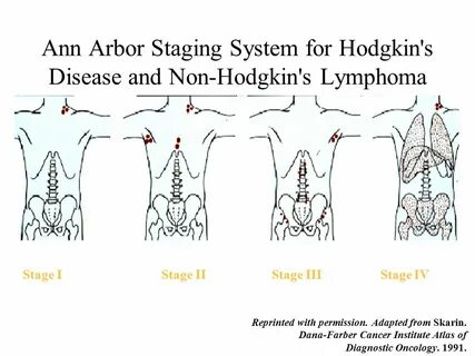 Lymphomas: The Basics Brad Kahl, MD Assistant Professor of M