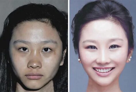 Как пластическая хирургия меняет всё / фото 2022
