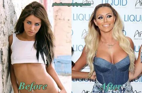 Aubrey O' Day Plastic Surgery Breast, Butt Implants Before A