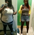10 Breathtaking Before-And-After Weight Loss Pics You Wont F