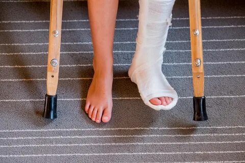 Перелом ноги в отпуске обошелся женщине в 3 миллиона рублей 