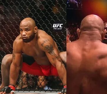 🔥 Notice the scar from Yoel Romero's neck to back? ⚡ By 2011