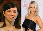 Celebrity Plastic Surgery: Before and After Pictures - Page 