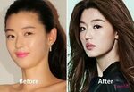 Did Jun Ji-hyun get plastic surgery? Here are some "obvious"