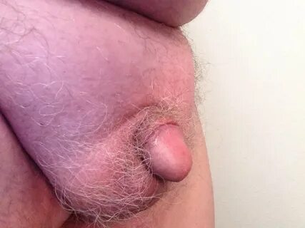 Uncut micro penis - 1 Pics xHamster