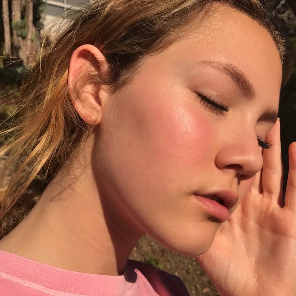 Iris Apatow Ð² Instagram: "I would say I have lost 50% of my sight afte...