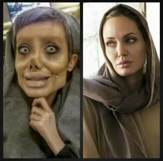 Angelina Jolie Plastic Surgery It Is Said That She Has Under