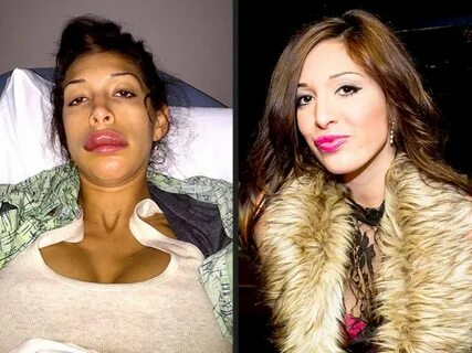 Farrah Abraham Before and After Plastic Surgery - Then & Now