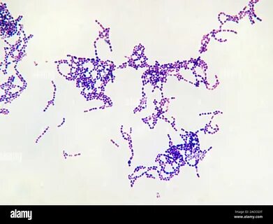 Streptococcus pyogenes bacteria, light micrograph. These are