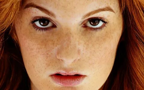 Beautiful Red Heads With Freckles