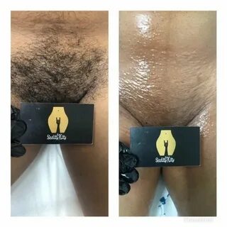 Brazilian Wax / Brazilian Waxing For Women Beauty Grace