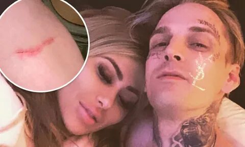 American singer Aaron Carter’s girlfriend arrested as he claims she choked him