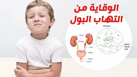 اعراض التهاب البول عند الاطفال والرضع وطرق العلاج والوقاية -