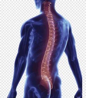 Ücretsiz indirin Sırt ağrısı Omurga kolonu Cerrahisi Spinal 