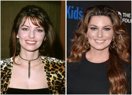 Shania twain plastic surgery - Plastic Surgery