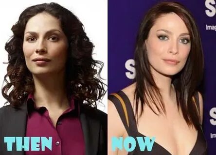 Joanne Kelly Plastic Surgery Before and After Photos - Lovel