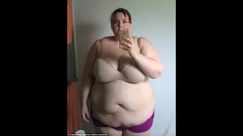 Obese Teacher Wears Bikini For The First Time After Losing 2