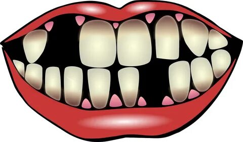 Tooth clipart dental checkup, Picture #2140793 tooth clipart