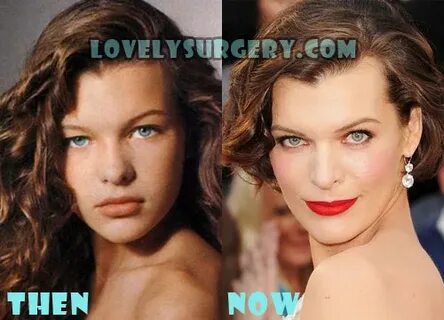 Milla Jovovich Plastic Surgery Botox - Lovely Surgery