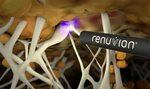 Renuvion J-Plasma Skin Tightening Dr. Sudeep Roy, RefinedMD