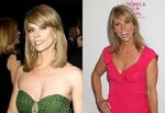 Cheryl Hines Plastic Surgery Before And After Pictures