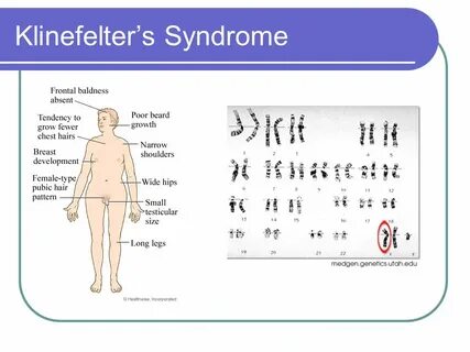 Mutations and other genetic issues - ppt video online downlo