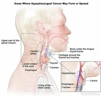Types/head-and-neck/patient/adult/hypopharyngeal-treatment-p