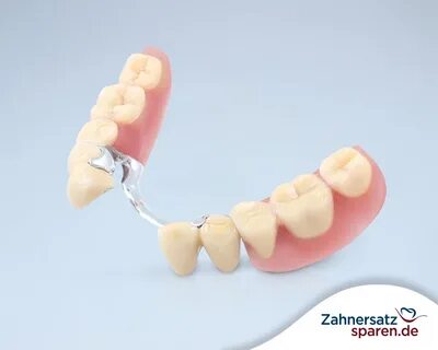 Teilprothese für die Zähne - Arten, Anwendungsbereiche und K