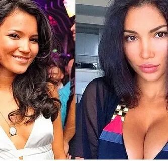 10 Pictures Of Instagram Celebrities Before Plastic Surgery 