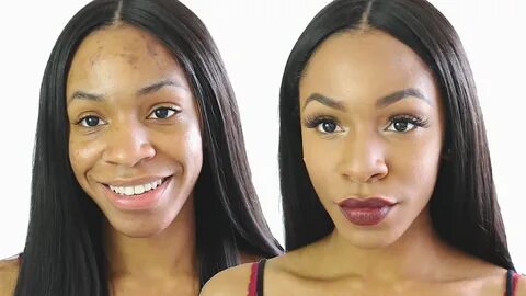 DIY: Homemade Tricks For Getting Rid of Acne - AccelerateTv