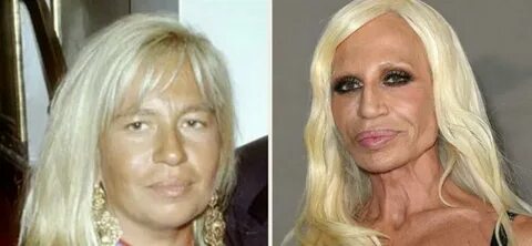 Plastic surgery stars Before and After newest secrets we upd