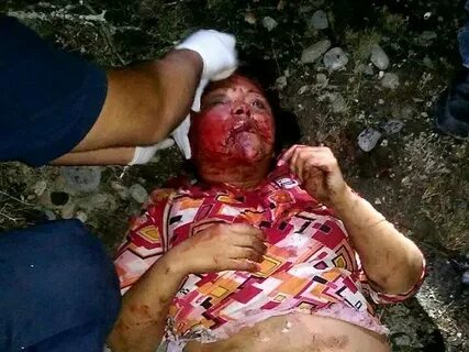GRAPHIC TERROR: Mexican Cartel Tried to Burn Woman Alive