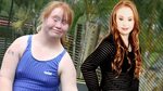 Teenager With Down Syndrome Becomes A Supermodel - YouTube