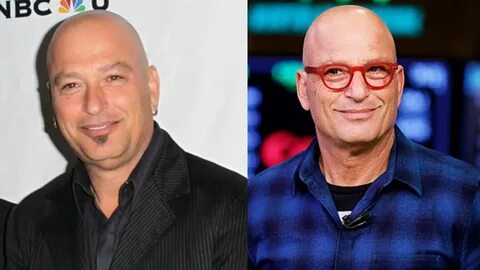 Howie Mandel's Plastic Surgery is Making Rounds on the Inter