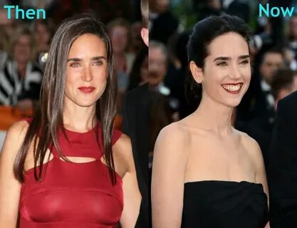 Jennifer Connelly Breast Reduction Before and After Flickr