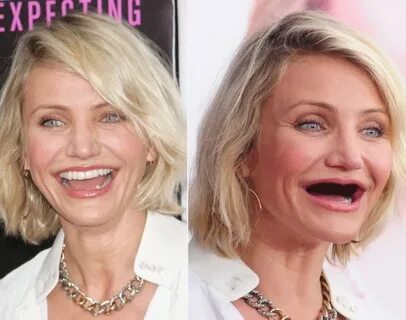 Celebrities without teeth: Stars get makeovers without their